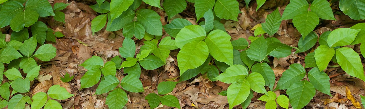 How To Treat Poison Ivy And Poison Oak Rashes In Kids Children S National,Coin Dealers Near Me Now