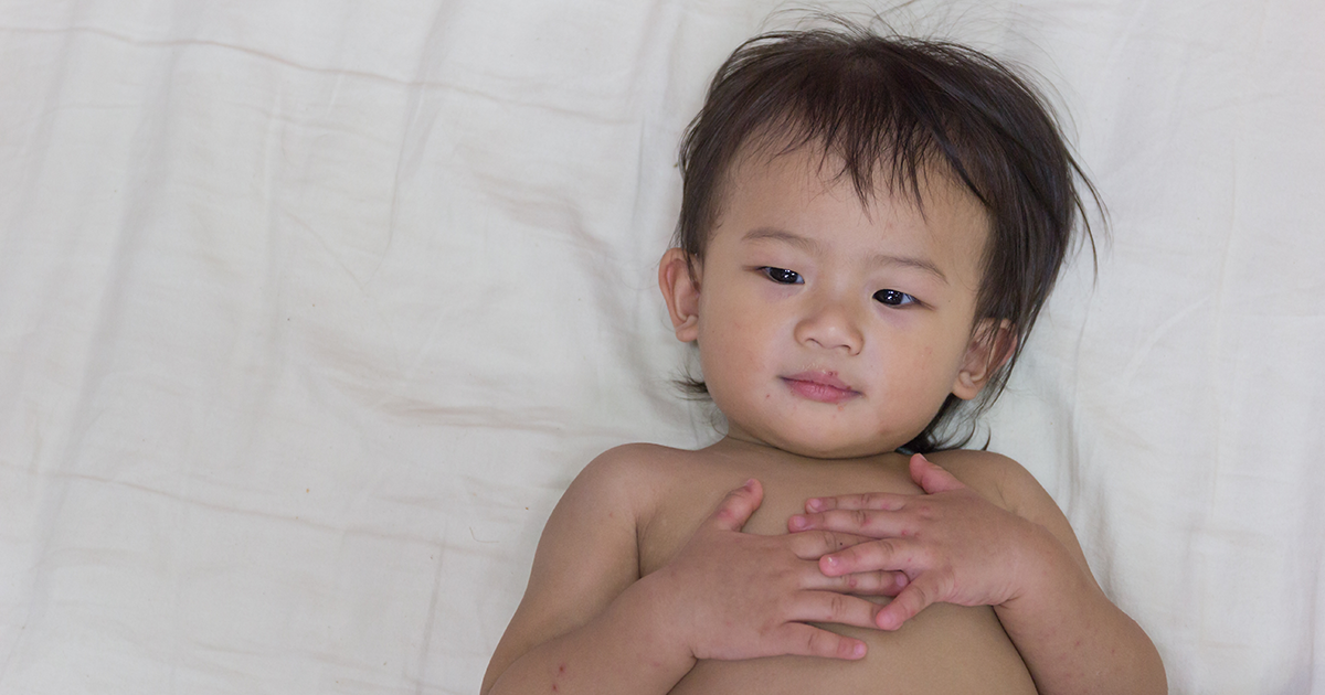 Q&A What is hand, foot and mouth disease? Children's National