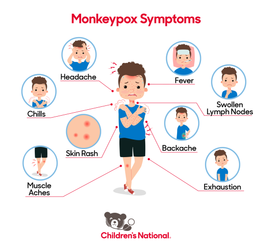 infographic of monkeypox symptoms