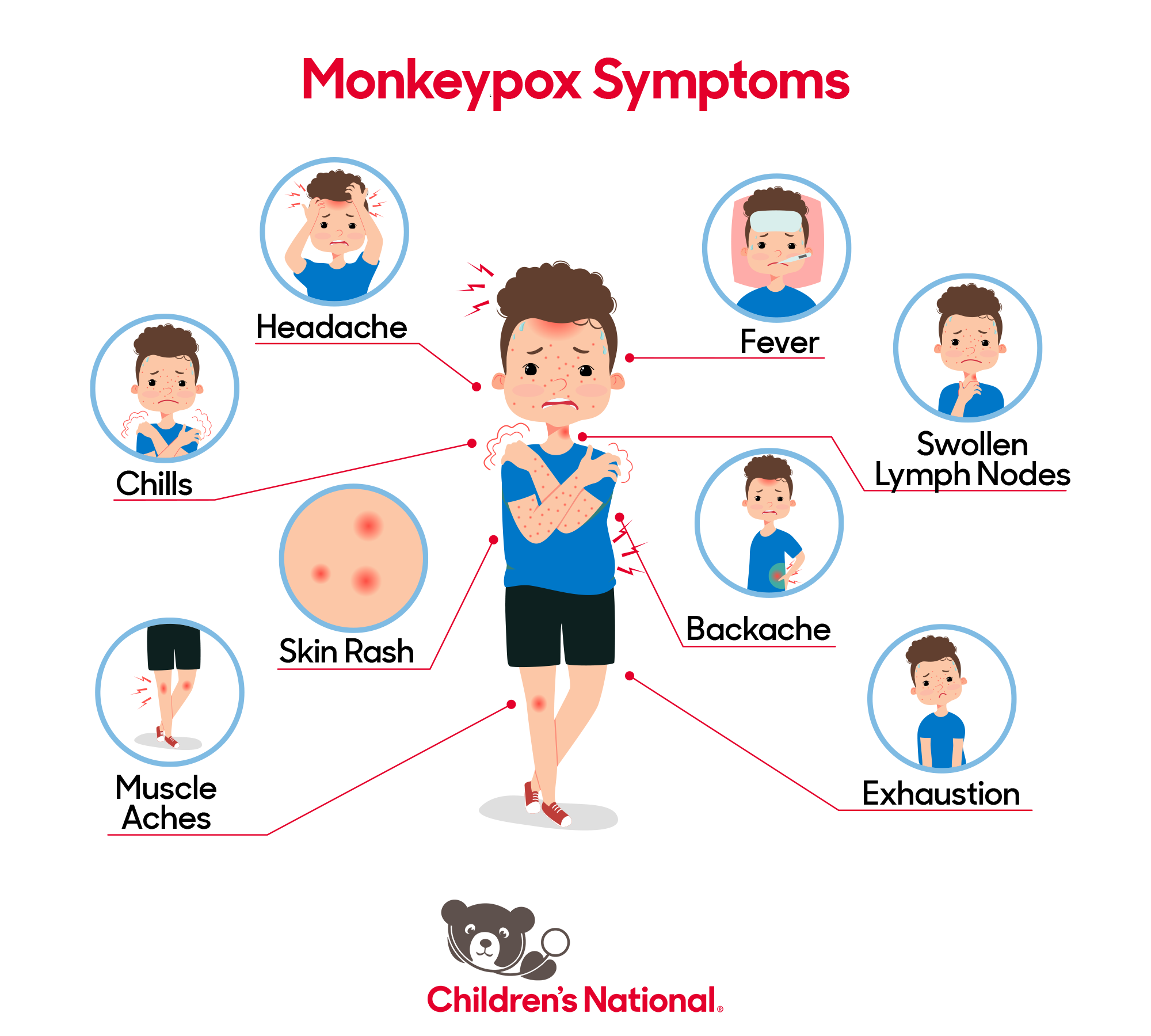 Monkeypox Pictures: How to Identify Symptoms of Monkeypox